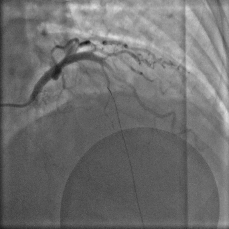 Biomedical Imaging